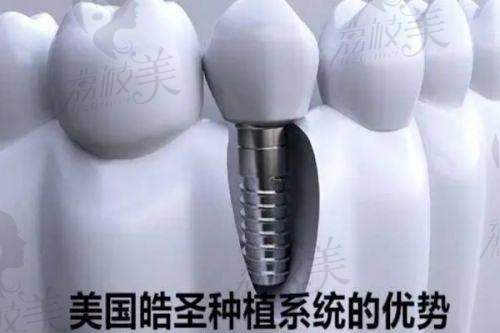 【成都安琪儿口腔科擅长什么项目】