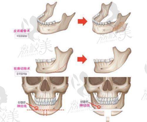 一、上海德琳医疗美容医院怎么样？