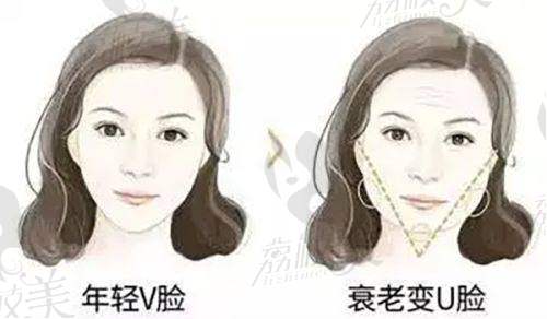 济南激光脱毛哪家医院做的好？选择医院的注意事项