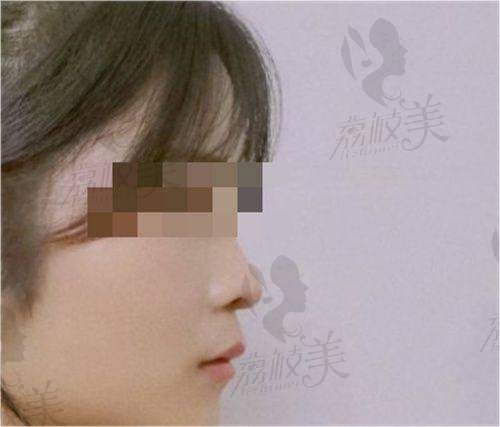 六、六安市人民医院整形科价格表：（仅供参考）