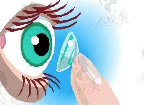 上饶爱尔眼科医院特色项目：
