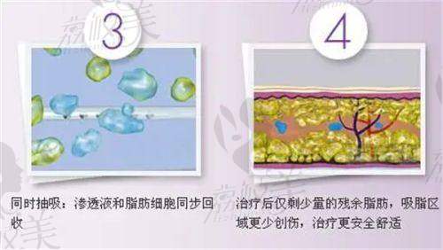 如何选择高难度眼修复醫生