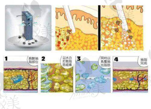 刘黄霞患者评价