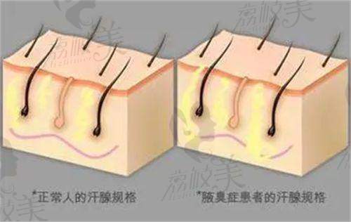 高難度眼修複的價格分階情況