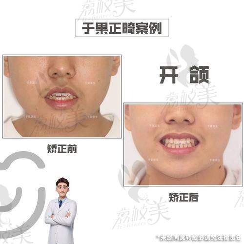 刘可乐正畸医生个人资质