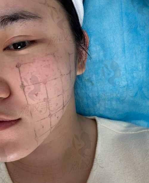 适应人群各不同