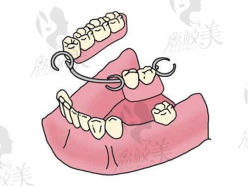 【杭州中瑞联合口腔门诊部怎么预约挂号】
