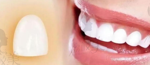 小成本大变化,“¥1280起”的笑容值不值?