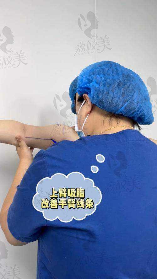 中山贝熙医疗美容王牌医生：打造美臂的神奇魔法师