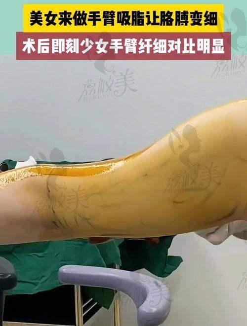 中山贝熙医疗美容全方面服务：让你美得舒舒服服