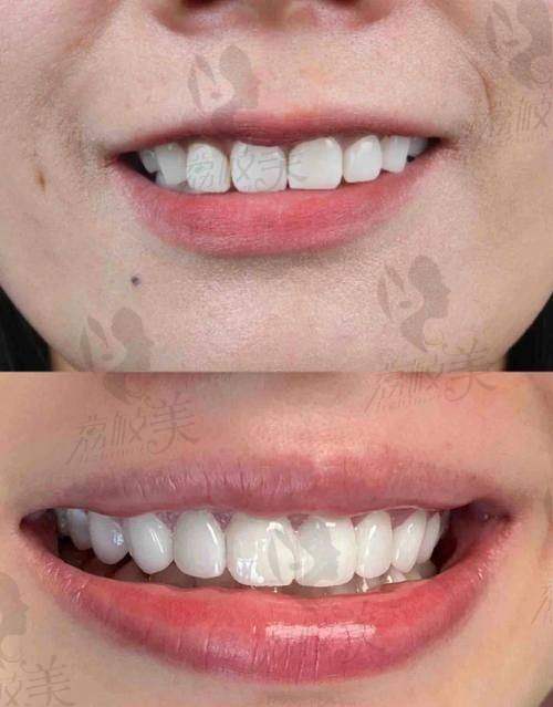 结语:即刻开启你的笑容新篇章