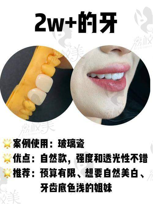 价格性价比亮眼,美笑计划背后的“实在派”