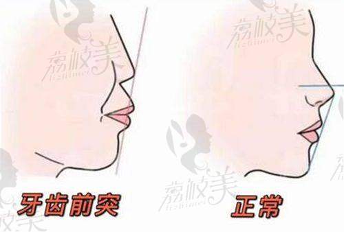 重庆佳辰鹏博口腔正规吗？正规连锁牙科，牙齿矫正8000元起，附医生介绍