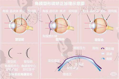 广州普瑞眼科医院骨干医生团队实力雄厚