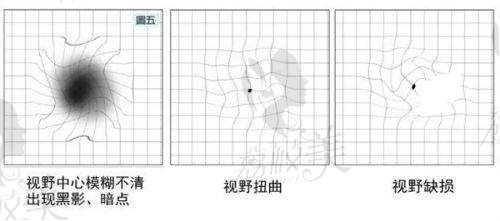 六、重庆华厦眼科医院预约挂号服务