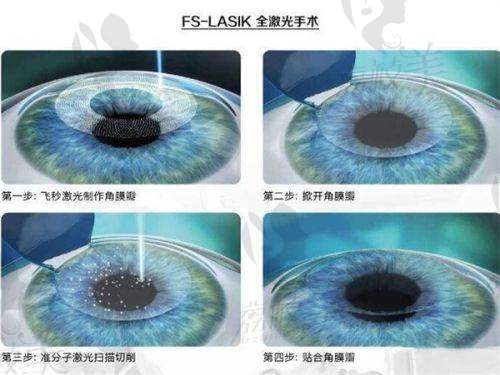 广州普瑞眼科医院优势科室特色突出
