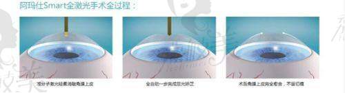 苏州光明眼科医院：优质骨干医生团队