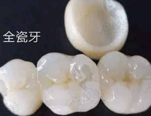 从适用人群看:不是人人都需要用“瑞锆”