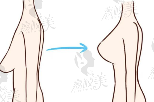 广西医 科 大学第一附属医院医疗美容科地址及乘车路线：