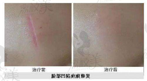 二、罗恩醫生为何在成都友谊醫院坐诊