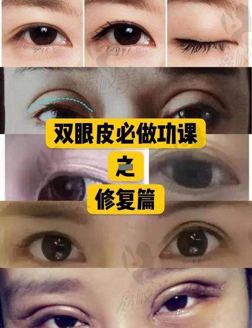 探讨广州孙恺和戚昌栋哪个好，从双眼皮专业领域到口碑评价大揭秘