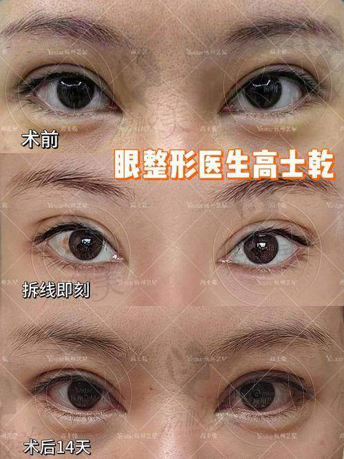 張立濤醫生是成都中医大银海醫院具有影响力口腔颌面整形科醫生，专注眼部修复有一套