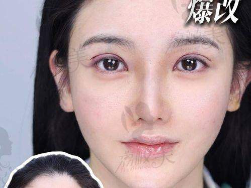 張立濤醫生的特需號VS普通號，怎么选？哪个更划算？