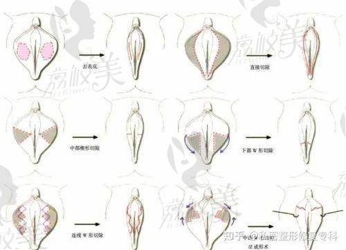 八大處李峰永做私密怎樣？值得深入了解和信任