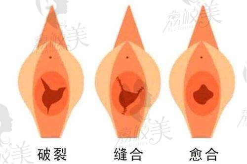 八大处李峰永做私密怎样？求美者口碑好醫生技术稳定成功案例多