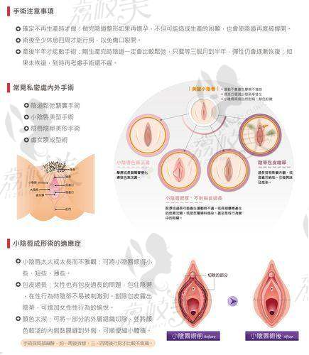 真實實例揭秘李峰永口碑——不只是緊，還有“細”
