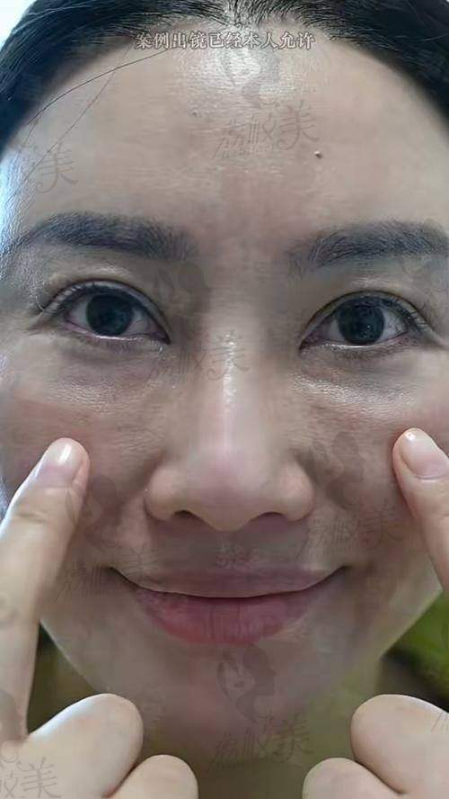 患者真實反饋：取生長因子後到底感覺如何？