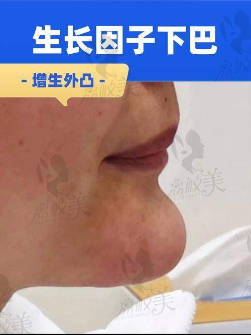 外地求美者能约到黎星醫生吗？时间安排和流程一览