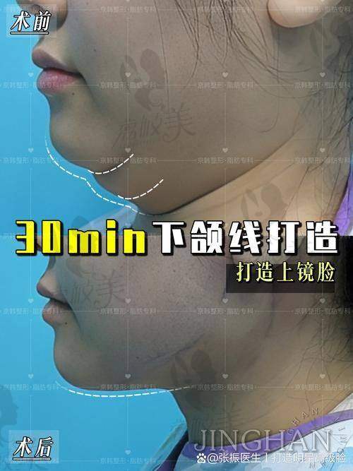 中山贝熙医疗美容王牌医生:打造小脸的魔法大师