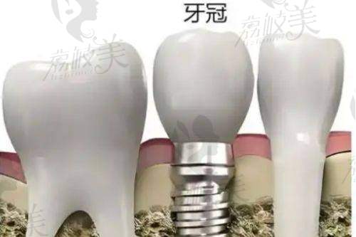 六、关于“国有医院牙科价格套路”的5句真言！务必牢记