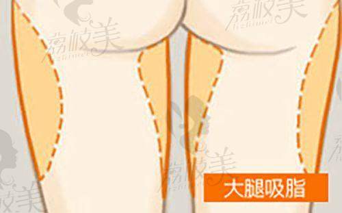二、河南省职工医院医疗美容科正规吗？来看看医院资质：