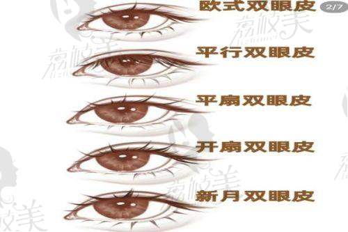 苏薇洁医生技术特点：