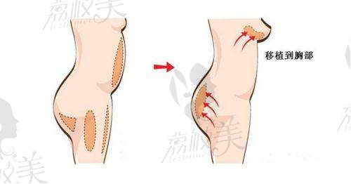 重庆东上医疗美容门诊部口碑怎么样？杨东运医生团队专业可靠，疤痕修复与鼻综合技术领先