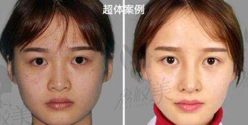 李华医生怎么预约挂号？