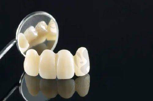 济南百年中牙口腔医院是公立的吗？正规二级专科医院，种植牙2980元起含进口种植体