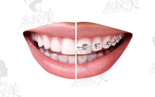 北京中诺第二口腔医院口碑怎么样？资质可靠、种植牙当天进食技术领先，价格透明无隐形消费
