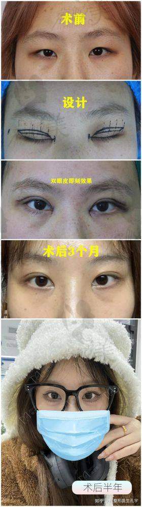 张余光医生擅长项目：