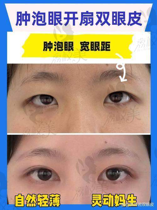 杨军 医生擅长项目：