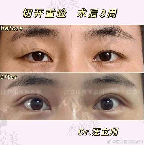 张余光医生荣誉资质：
