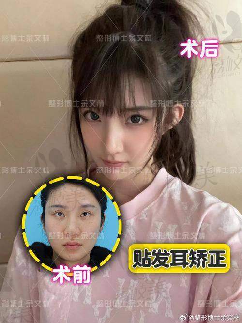 张群医生口碑怎么样？