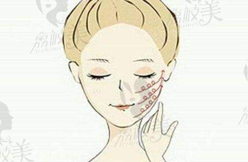 福州名韩整形美容医院温名赟曼托假体隆胸的综合实力