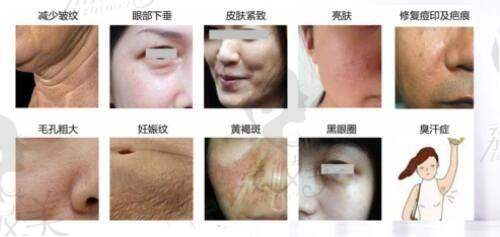 精灵耳整形需要多少钱啊？2025年杭州艺星李俊霞医生口碑好，价格8000-25000元