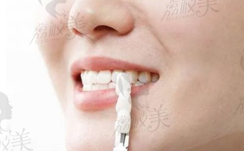 上海拜博口腔江亲远种植牙水平怎么样