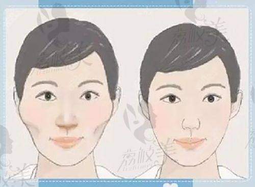 西安星容妍医疗美容价格表：