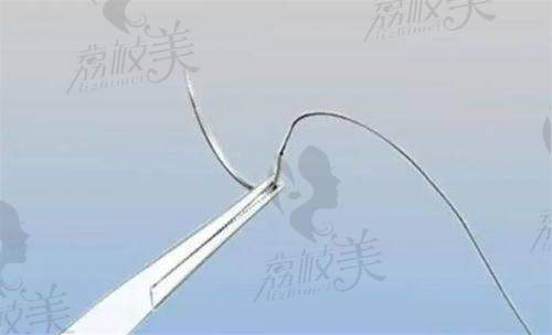 西安星容妍医疗美容电话号码：