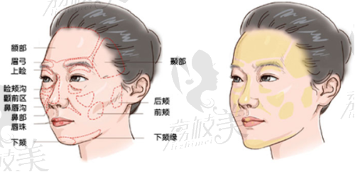 超体灵动鼻项目的成功实例与客户反馈